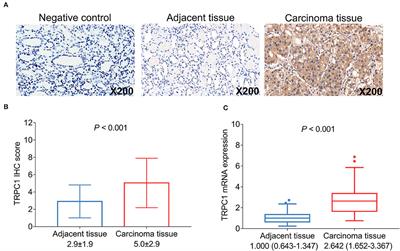 Transient Receptor Potential Channel 1 Potentially Serves as a Biomarker Indicating T/TNM Stages and Predicting Long-Term Prognosis in Patients With Renal Cell Carcinoma